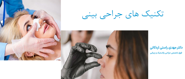 تکنیک های جراحی بینی