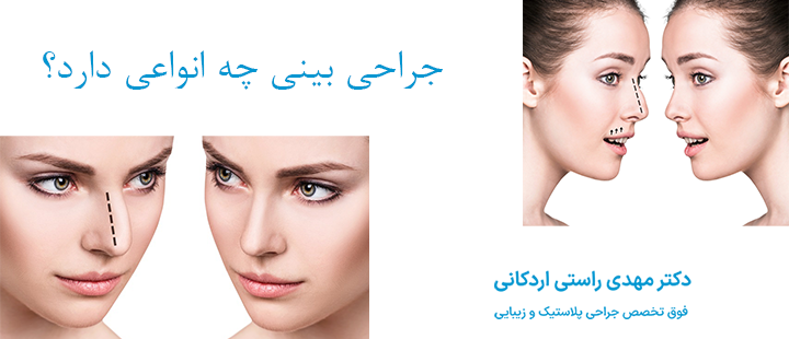 جراحی بینی چه انواعی دارد؟