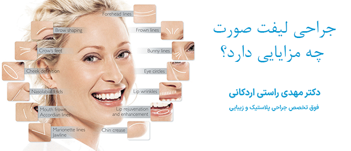جراحی لیفت صورت چه مزایایی دارد؟
