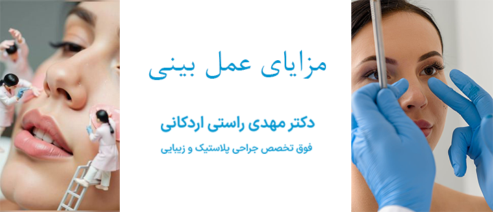 مزایای عمل بینی 