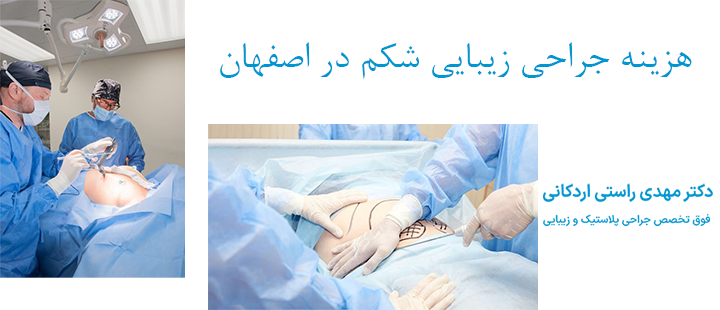 هزینه جراحی زیبایی شکم در اصفهان