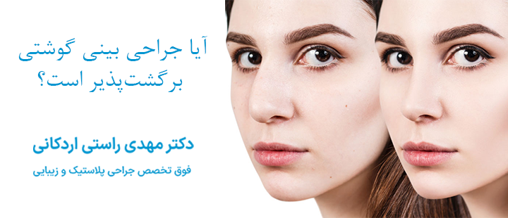 آیا جراحی بینی گوشتی برگشت‌پذیر است؟
