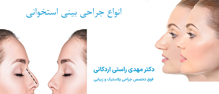 انواع جراحی بینی استخوانی 