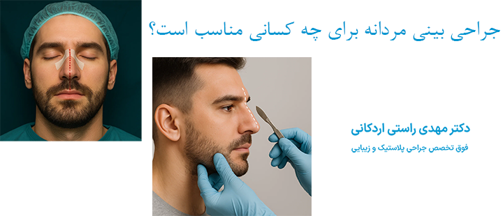 جراحی بینی مردانه برای چه کسانی مناسب است؟