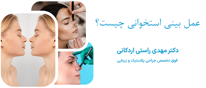 عمل بینی استخوانی چیست؟