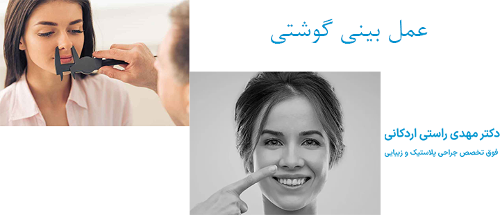 عمل بینی گوشتی چیست؟