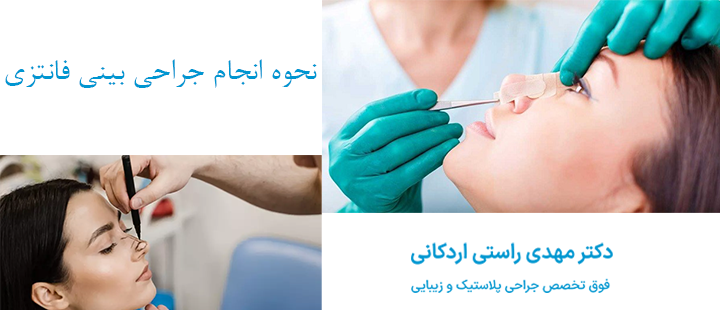 نحوه انجام جراحی بینی 