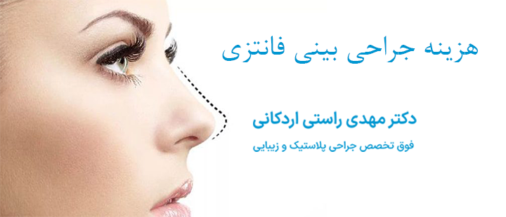 هزینه جراحی بینی فانتزی 