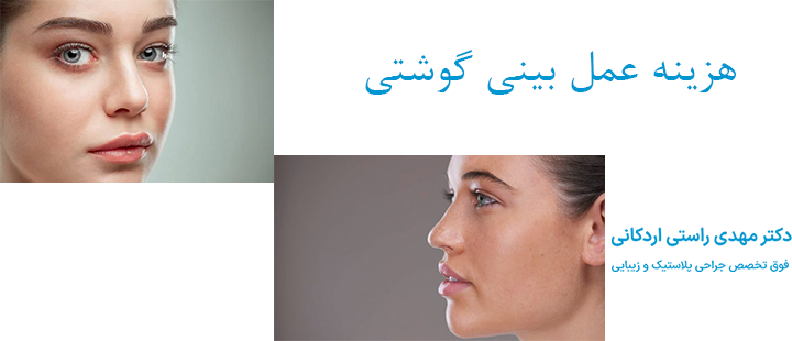 هزینه عمل بینی گوشتی