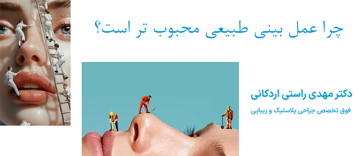 چرا عمل بینی طبیعی محبوب تر است؟