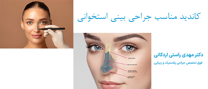 کاندید مناسب جراحی بینی استخوانی