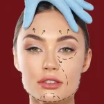 مراقبت های بعد از جراحی لیفت صورت