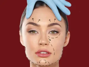مراقبت های بعد از جراحی لیفت صورت