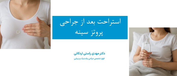 استراحت بعد از جراحی پروتز سینه 