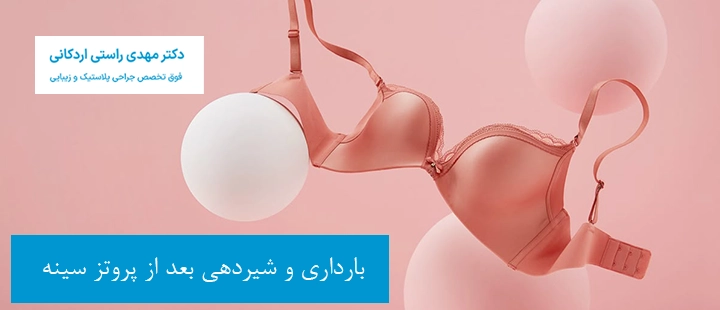 بارداری و شیردهی بعد از پروتز سینه 