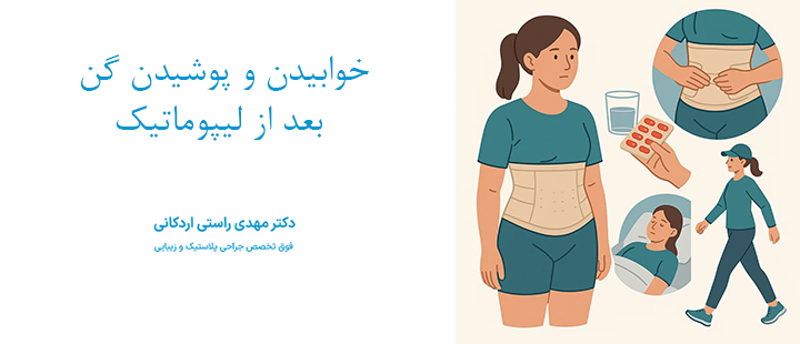 خوابیدن و پوشیدن گن بعد از لیپوماتیک 