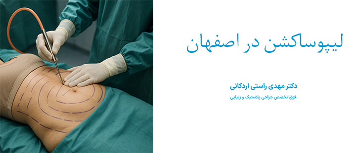 درباره لیپوساکشن در اصفهان 