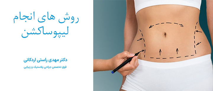 روش های انجام لیپوساکشن 