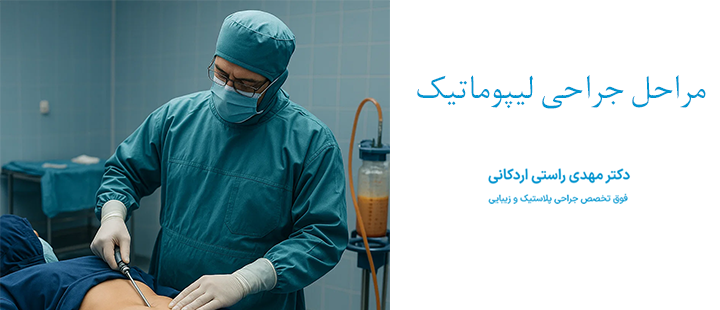 مراحل جراحی لیپوماتیک