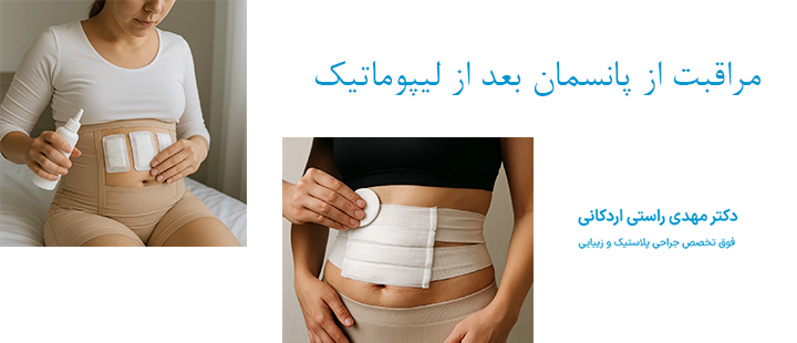 مراقبت از پانسمان بعد از لیپوماتیک
