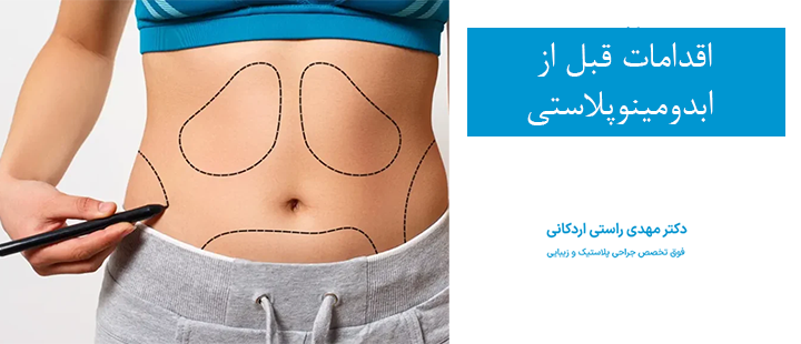 اقدامات قبل از ابدومینوپلاستی