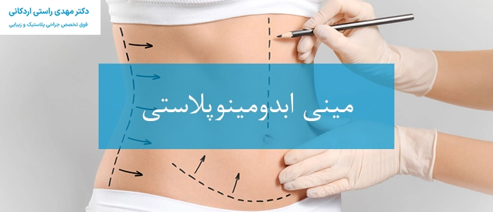 مینی ابدومینوپلاستی