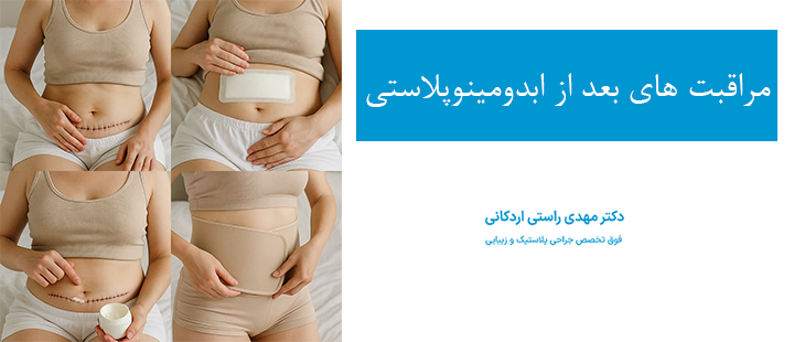 درباره مراقبت های بعد از ابدومینوپلاستی