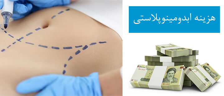 هزینه ابدومینوپلاستی در اصفهان