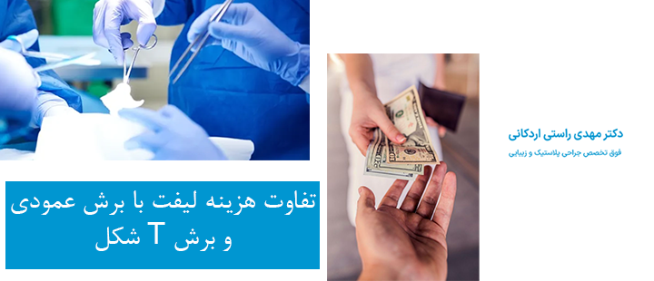 تفاوت هزینه لیفت با برش عمودی و برش T شکل