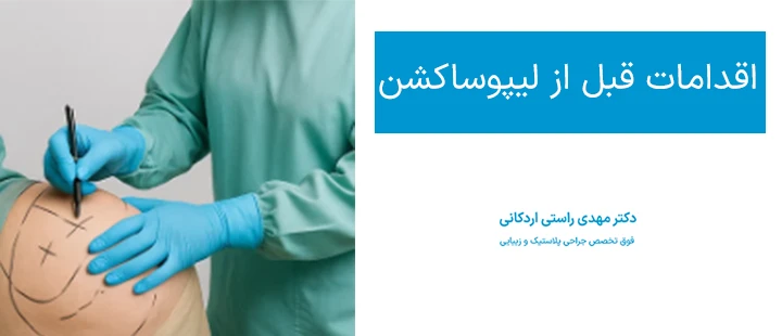 درباره اقدامات قبل از لیپوساکشن