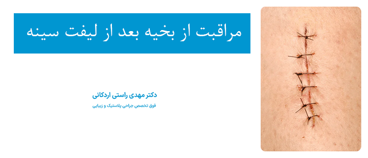 مراقبت از بخیه بعد از لیفت سینه