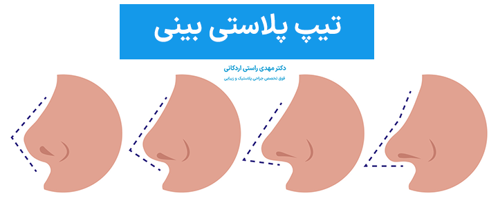 تیپ پلاستی بینی چیست؟