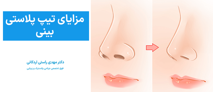 مزایای تیپ پلاستی بینی