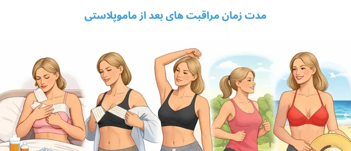 مدت زمان مراقبت های بعد از ماموپلاستی